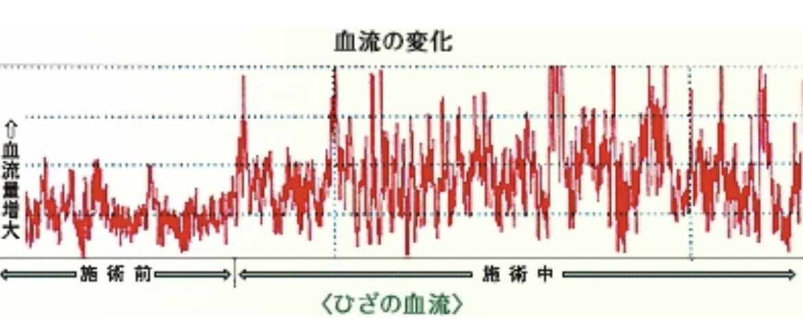 足ツボリフレクソロジー